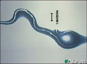 Lyme disease organism, Borrelia burgdorferi Lyme disease organism, Borrelia burgdorferi