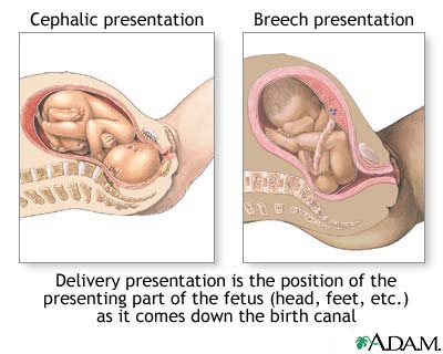 Delivery presentations Delivery presentations