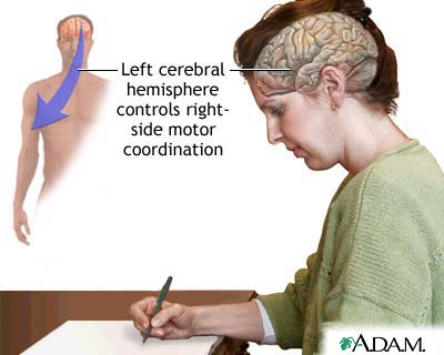 Left cerebral hemisphere - function Left cerebral hemisphere - function