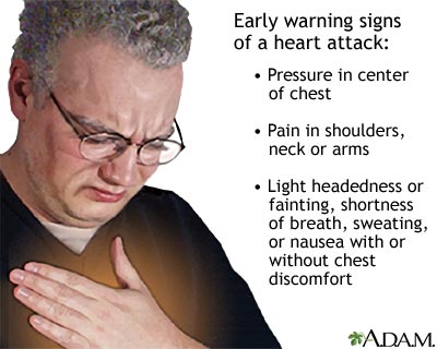 Heart attack symptoms