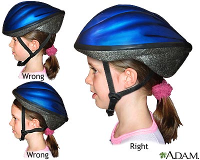 Bicycle helmet - proper usage Bicycle helmet - proper usage