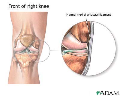 Medial collateral ligament Medial collateral ligament