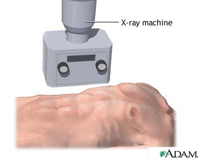 X-ray X-ray