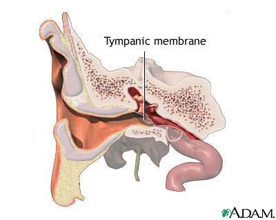 Tympanic membrane Tympanic membrane