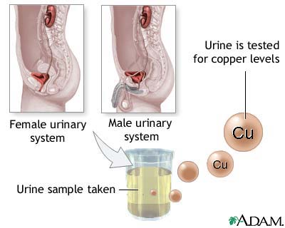 Copper urine test Copper urine test