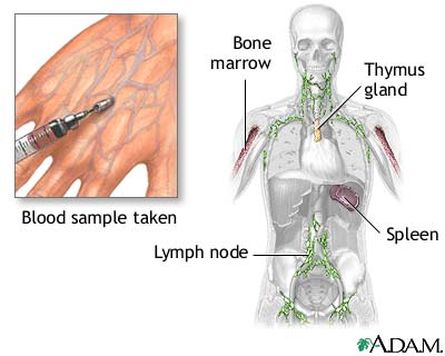 Nitroblue tetrazolium test