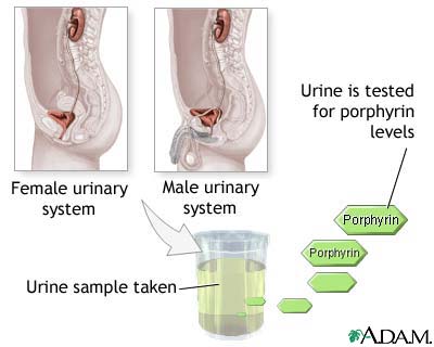 Porphyrin urine test